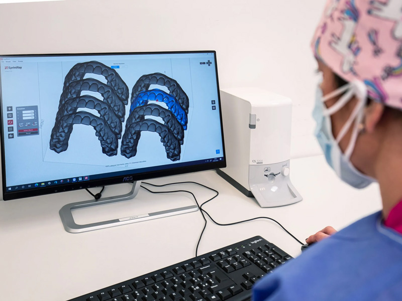 Studio Grendene - progettazione virtuale 3D degli spostamenti dentali e/o ossei con software professionali