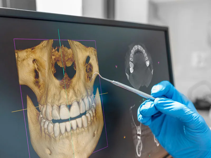 Studio Grendene - scanner intraorali che permettono di rilevare le arcate dentarie